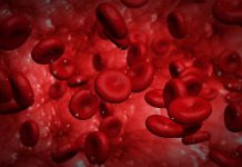 کم خونی پرنیشیوز چیست؟