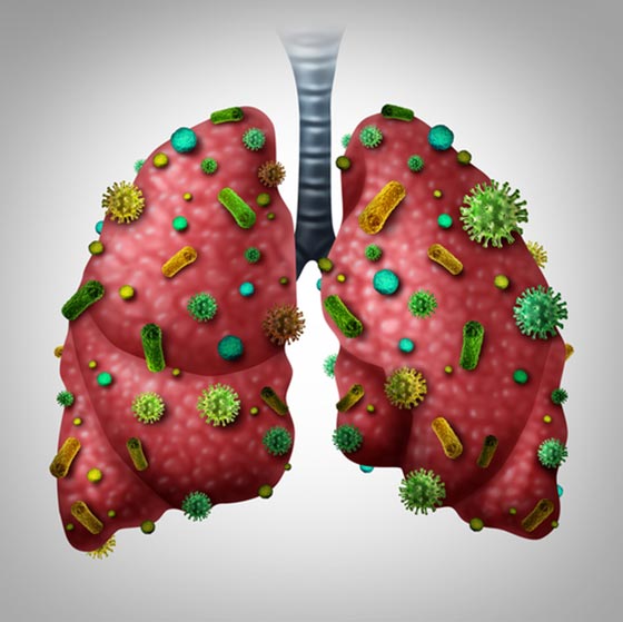 عفونت ریه چیست؟