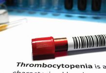 ترومبوسیتوپنی (پلاکت خون پایین) چیست؟