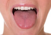 تاثیر بیماری کرون بر زبان