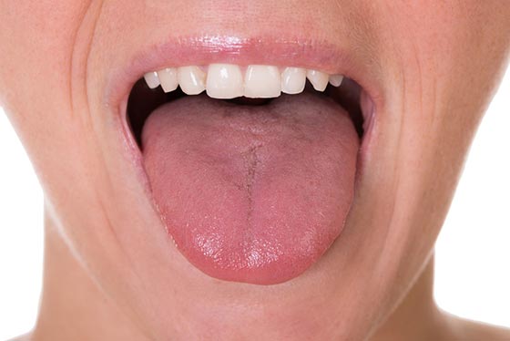 تاثیر بیماری کرون بر زبان 