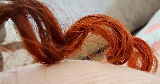 آیا ساس ها بر روی موهای انسان زندگی می کنند؟