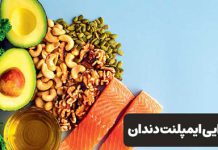 رژیم غذایی ایمپلنت دندان