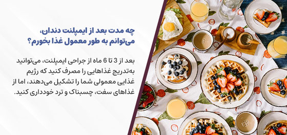 چه مدت بعد از ایمپلنت دندان، میتوانم به طور معمول غذا بخورم؟